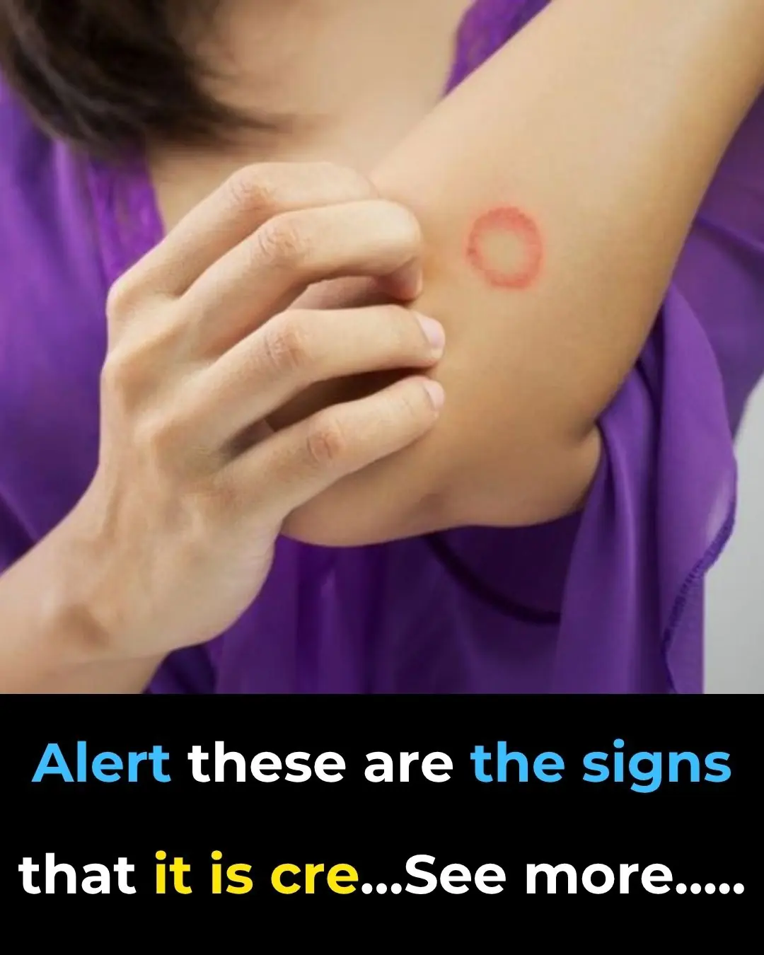 𩺠Unusual Case of Sweet Syndrome Triggered by New Inhaler Therapy in Primary Care