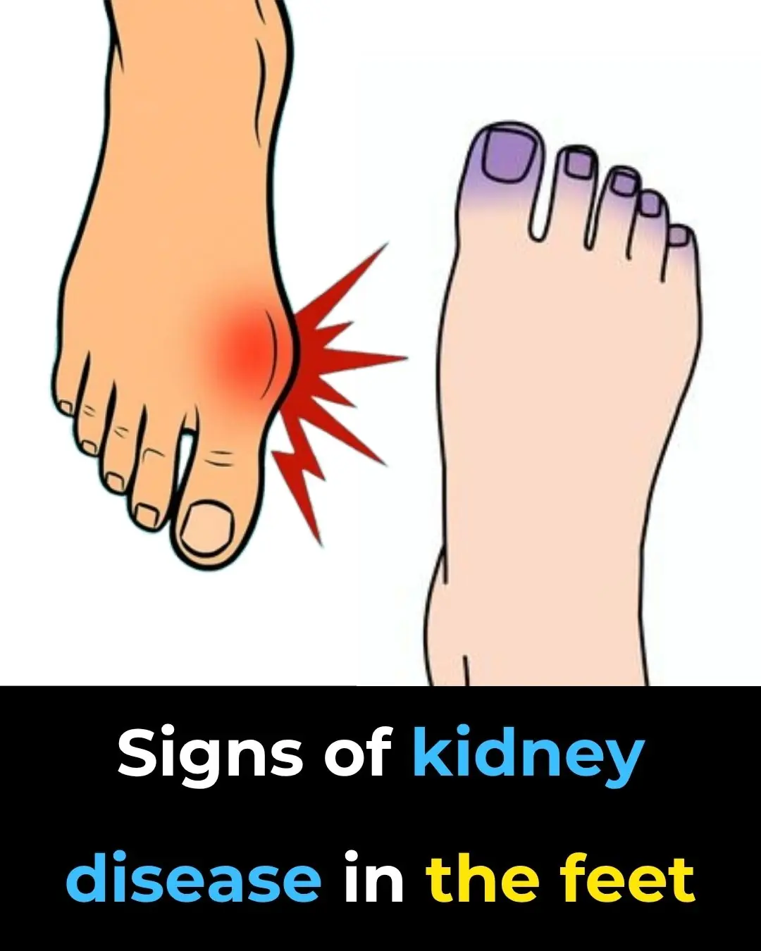 Foot Symptoms That Could Signal Kidney Problems