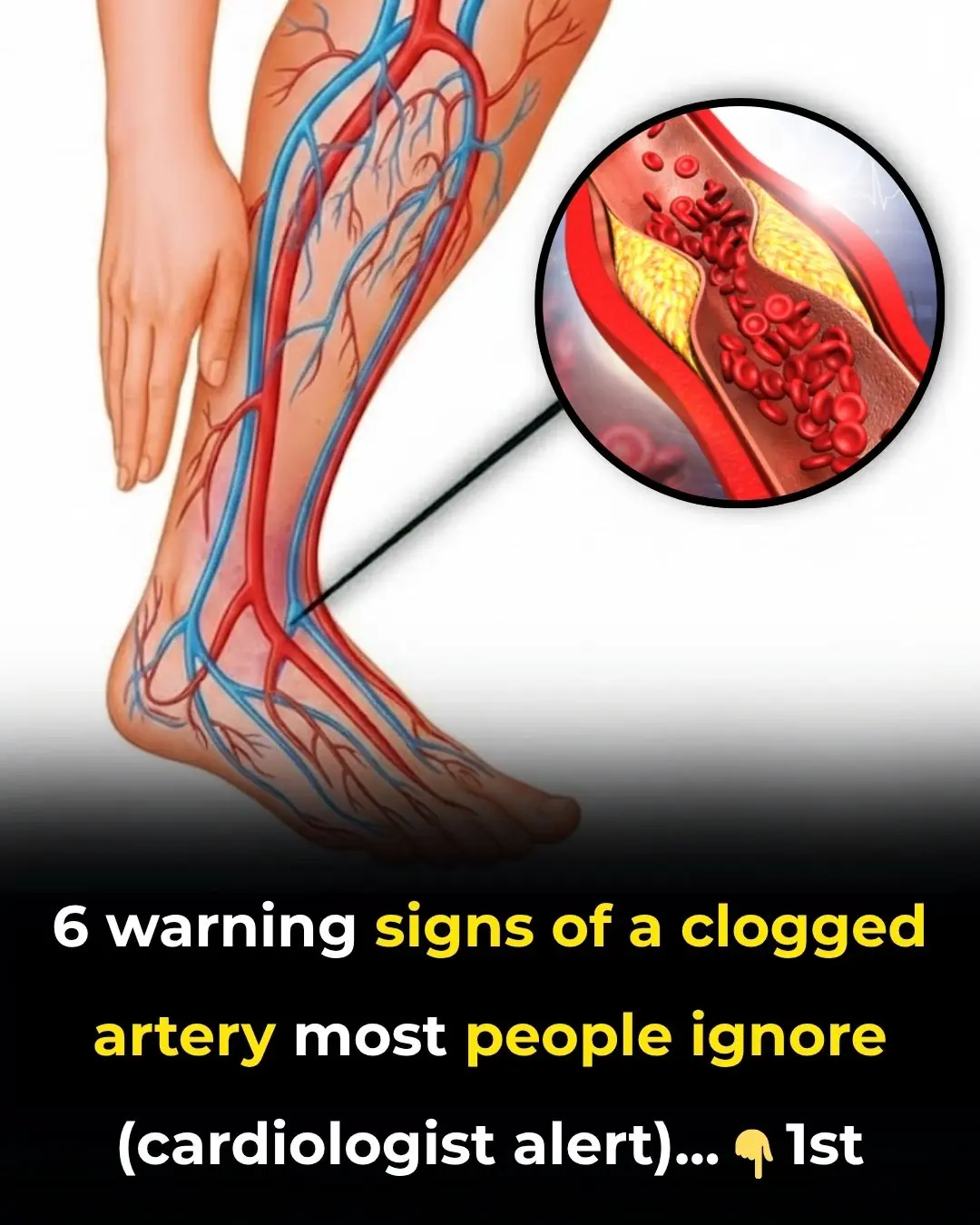 6 warning signs of a clogged artery most people ignore (cardiologist alert)