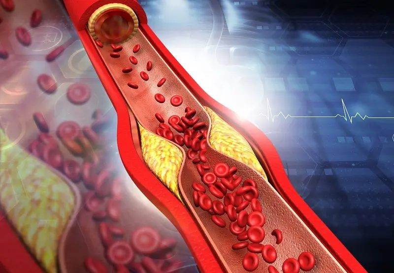 SUBTLE WARNING SIGNS OF CLOGGED ARTERIES AND HOW TO UNCLOG THEM NATURALLY