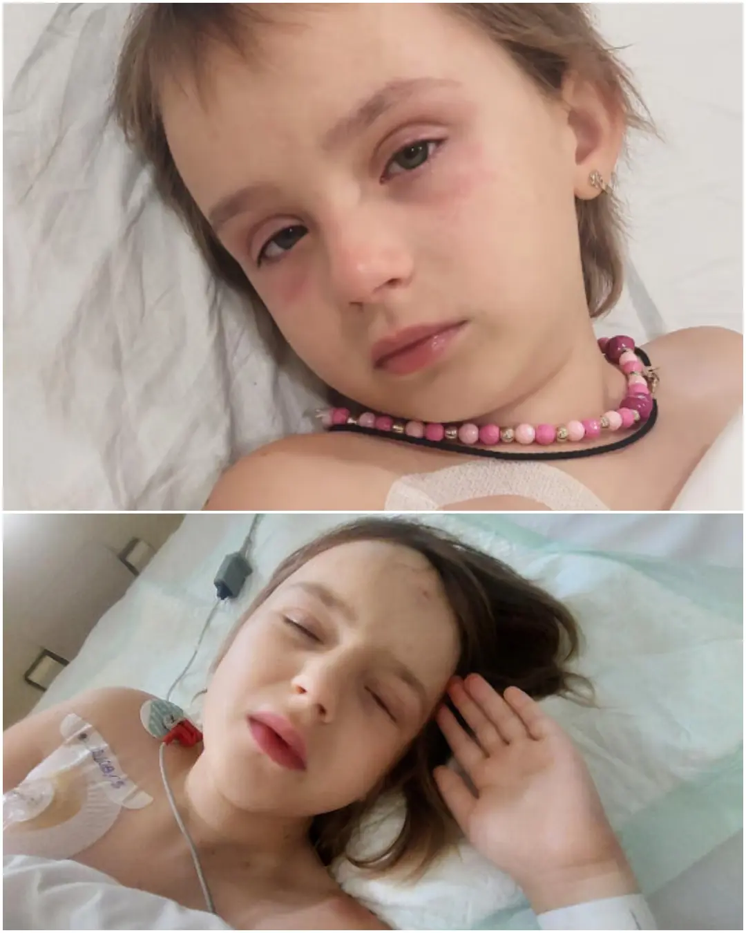 Every Day Is a Fight: Solomiyaâs Battle With Neuroblastoma