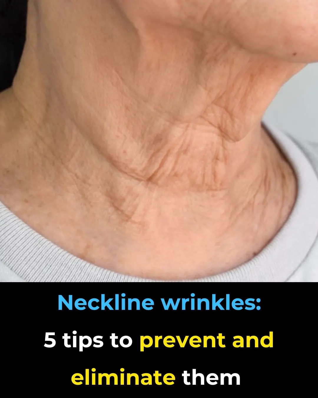Neckline Wrinkles 5 Tips to Prevent and Eliminate Them