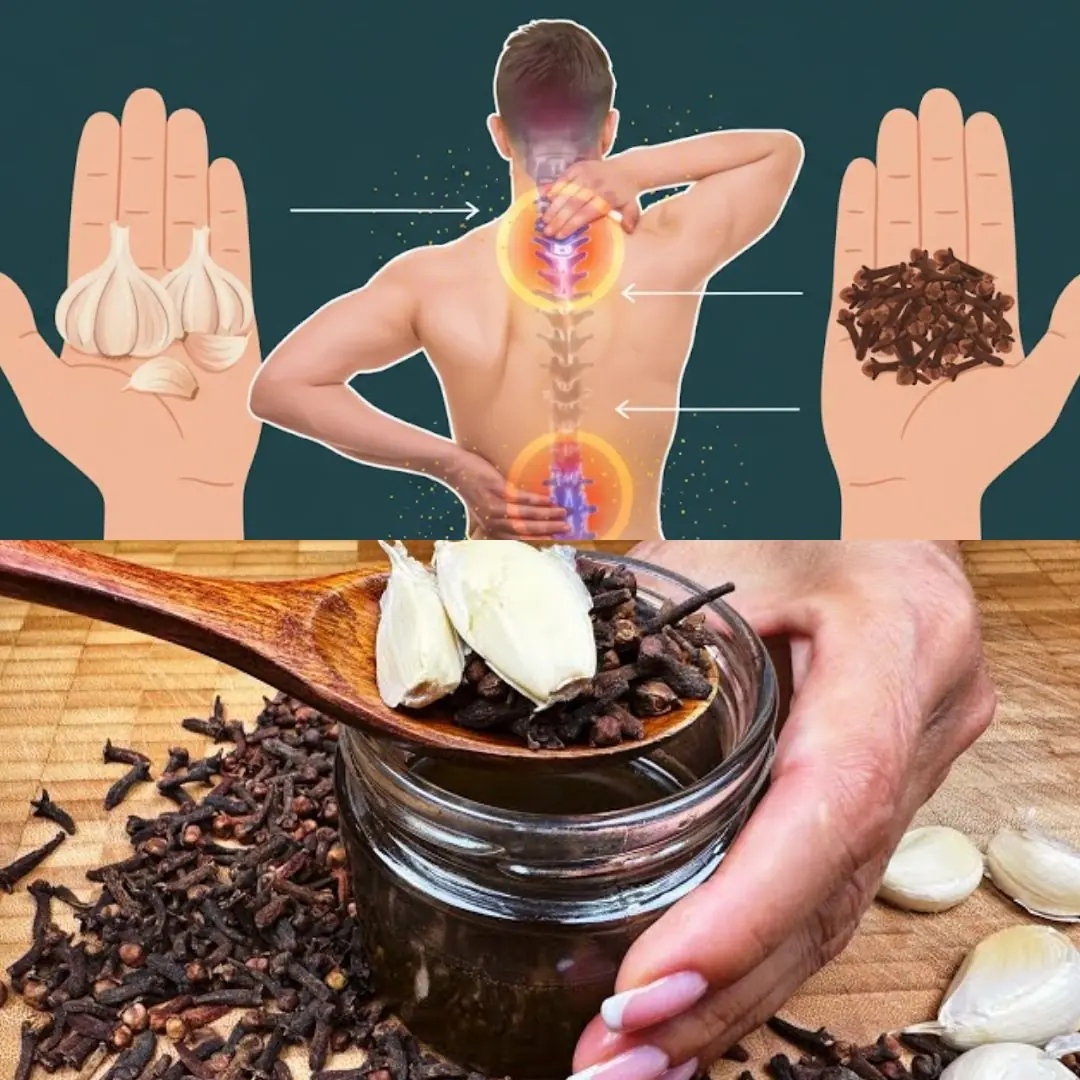 Garlic, Honey, and Cloves – a powerful natural remedy packed with health benefits