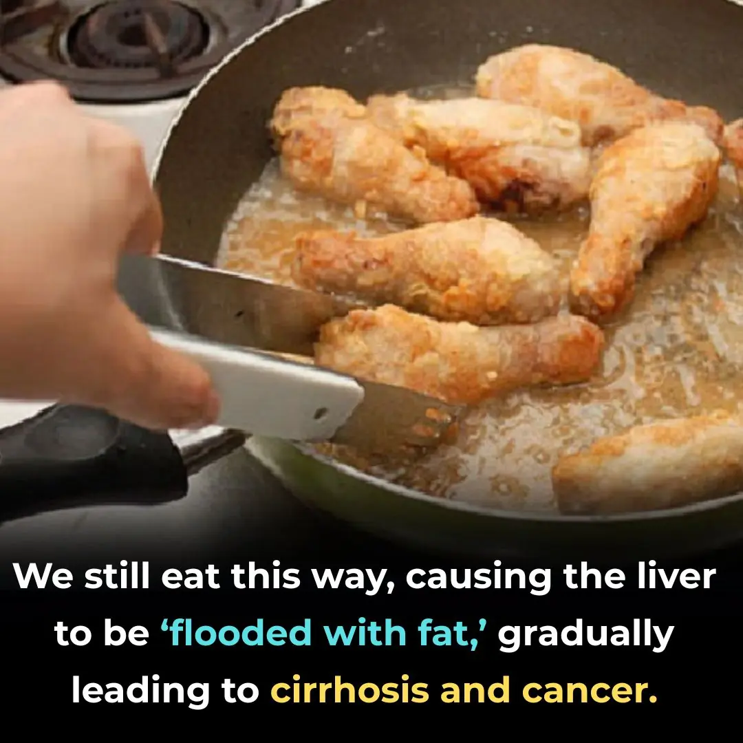 The Vietnamese Diet Habit That’s Damaging the Liver: A Silent Path Toward Fatty Liver, Cirrhosis, and Even Cancer