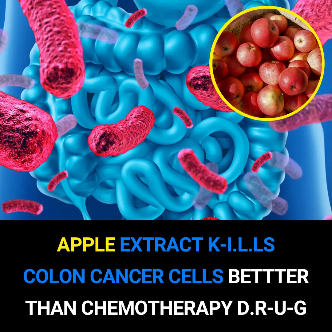 Apple Extract Found to Kill Colon Cancer Cells More Effectively Than Chemotherapy Drug