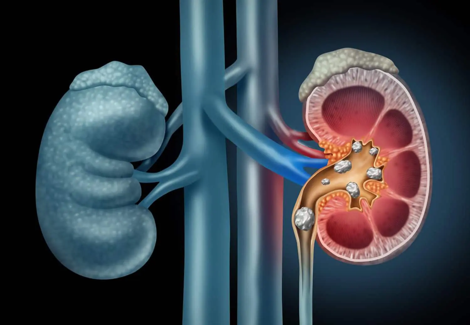 Top 10 Signs of Kidney Problems You Absolutely Must Be Aware Of