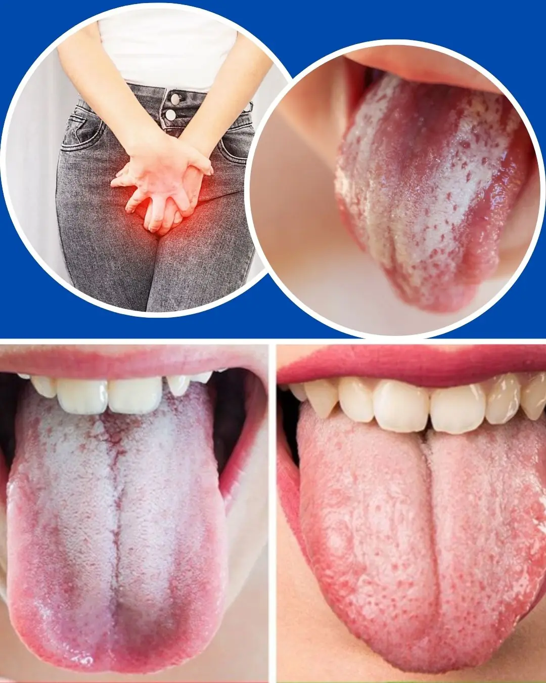 Listen to Your Tongue: 11 Subtle Health Messages It Sends Health June 11, 2025 Updated: June 11, 2025