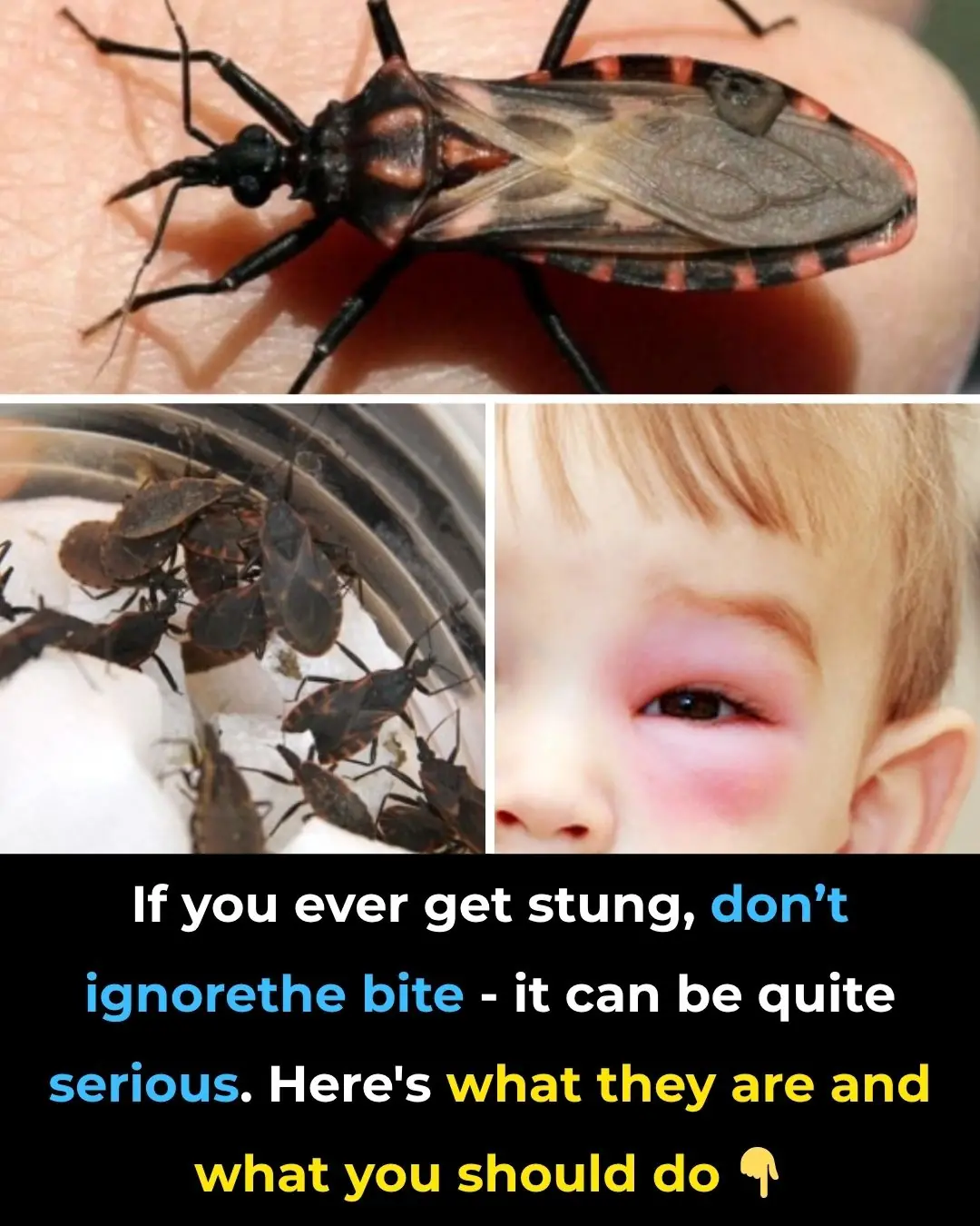 The Rise of Kissing Bugs