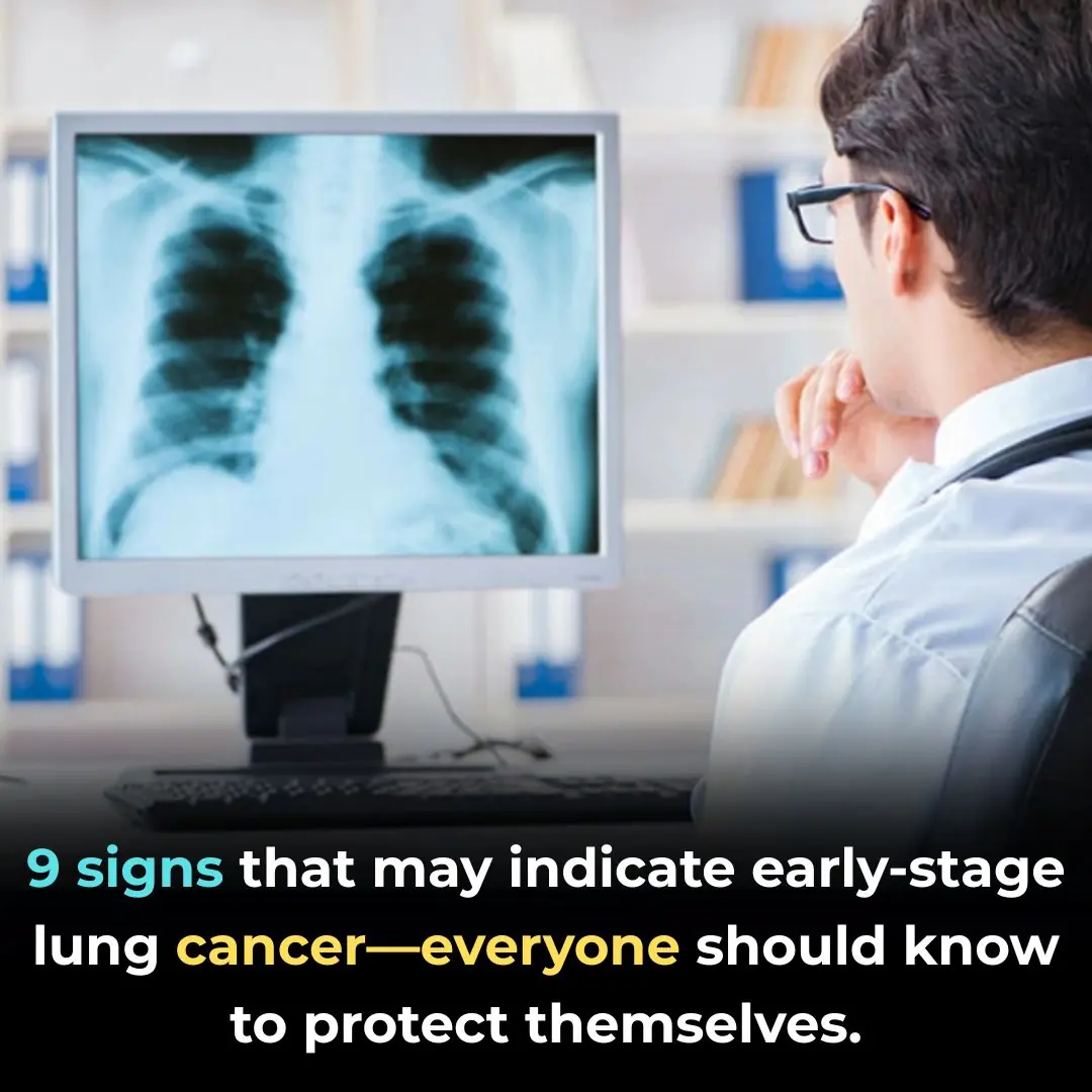 9 Early Warning Signs of Lung Cancer You Should Never Ignore