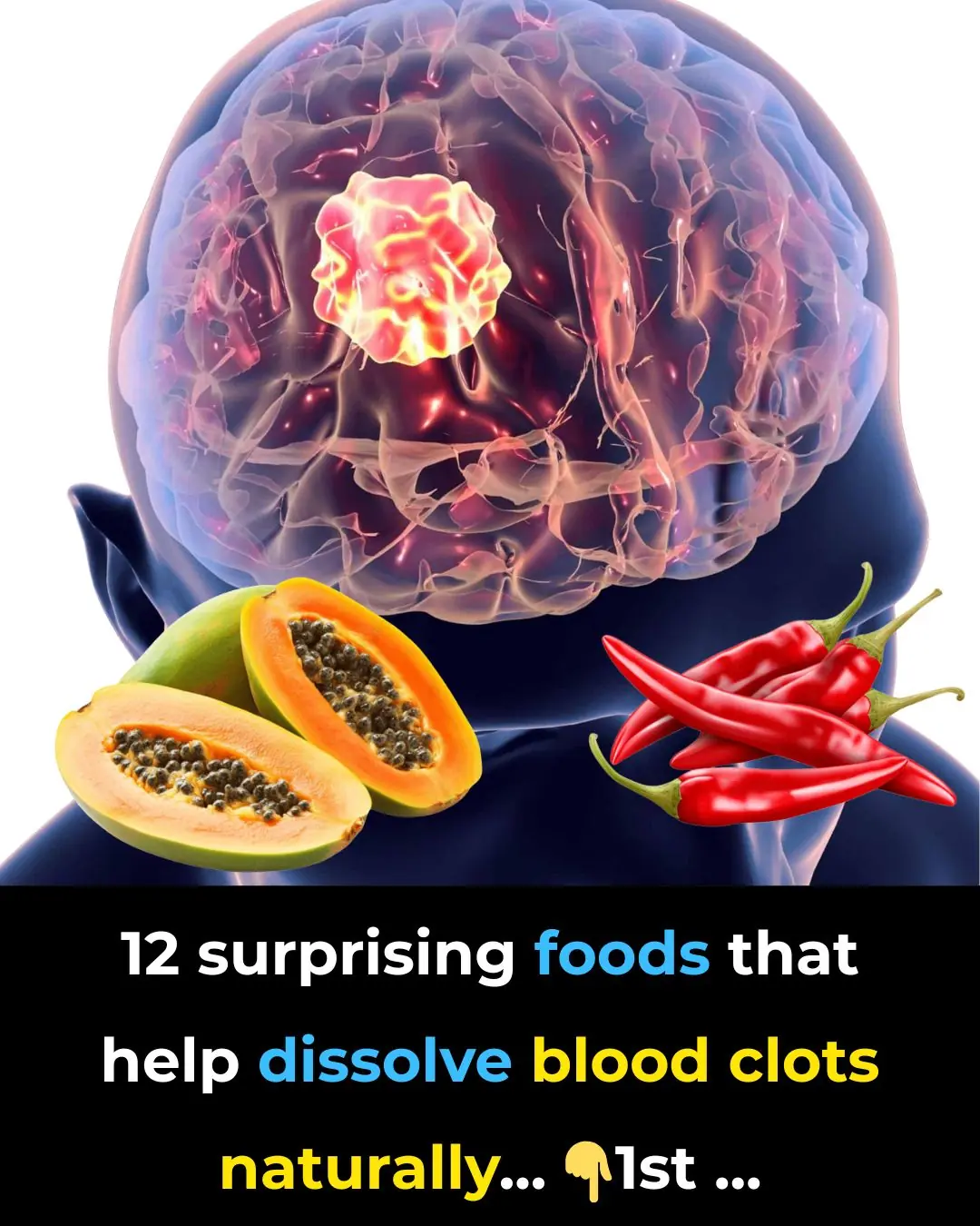 12 surprising foods that help dissolve blood clots naturally