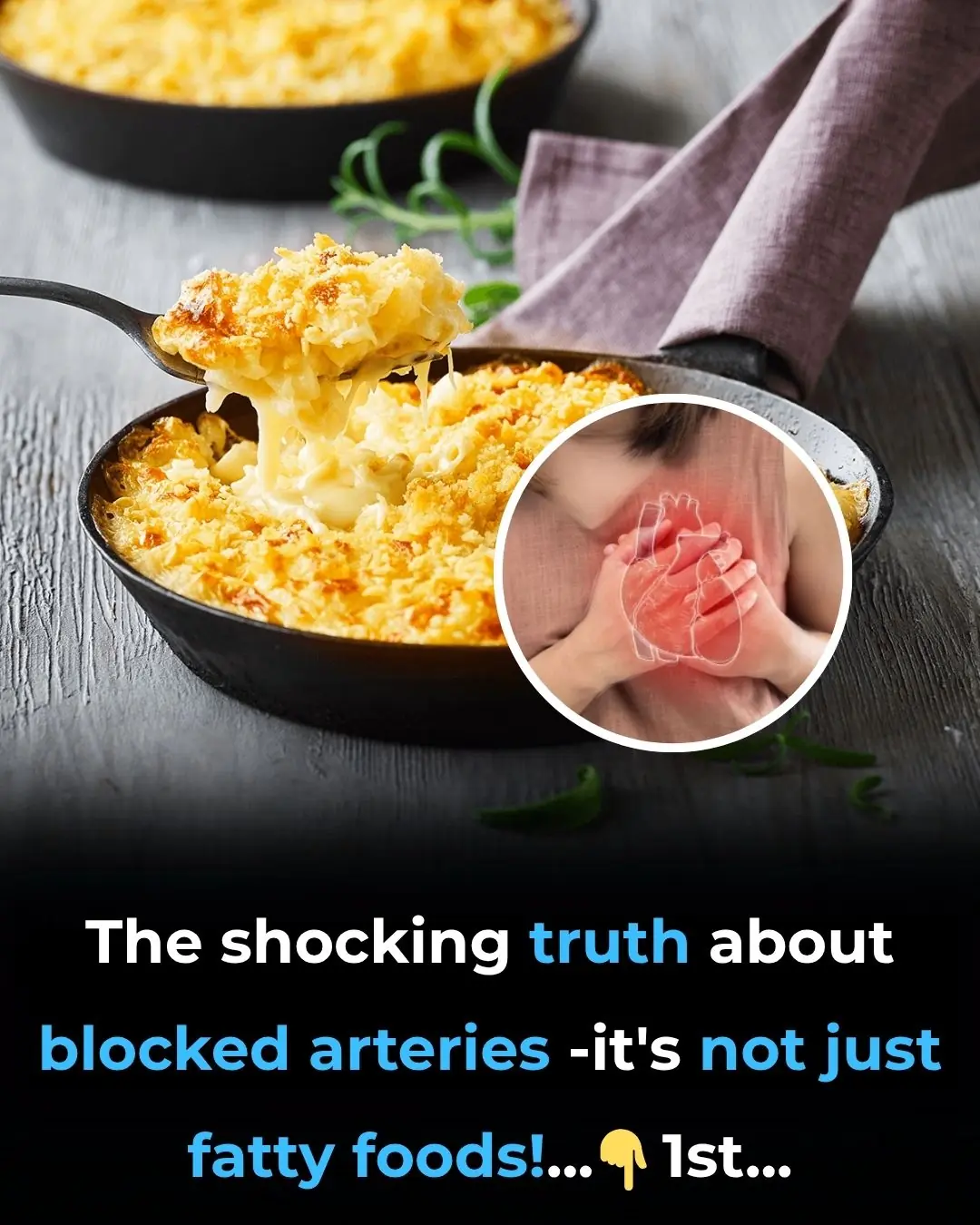 The shocking truth about blocked arteries—it’s NOT just fatty foods!