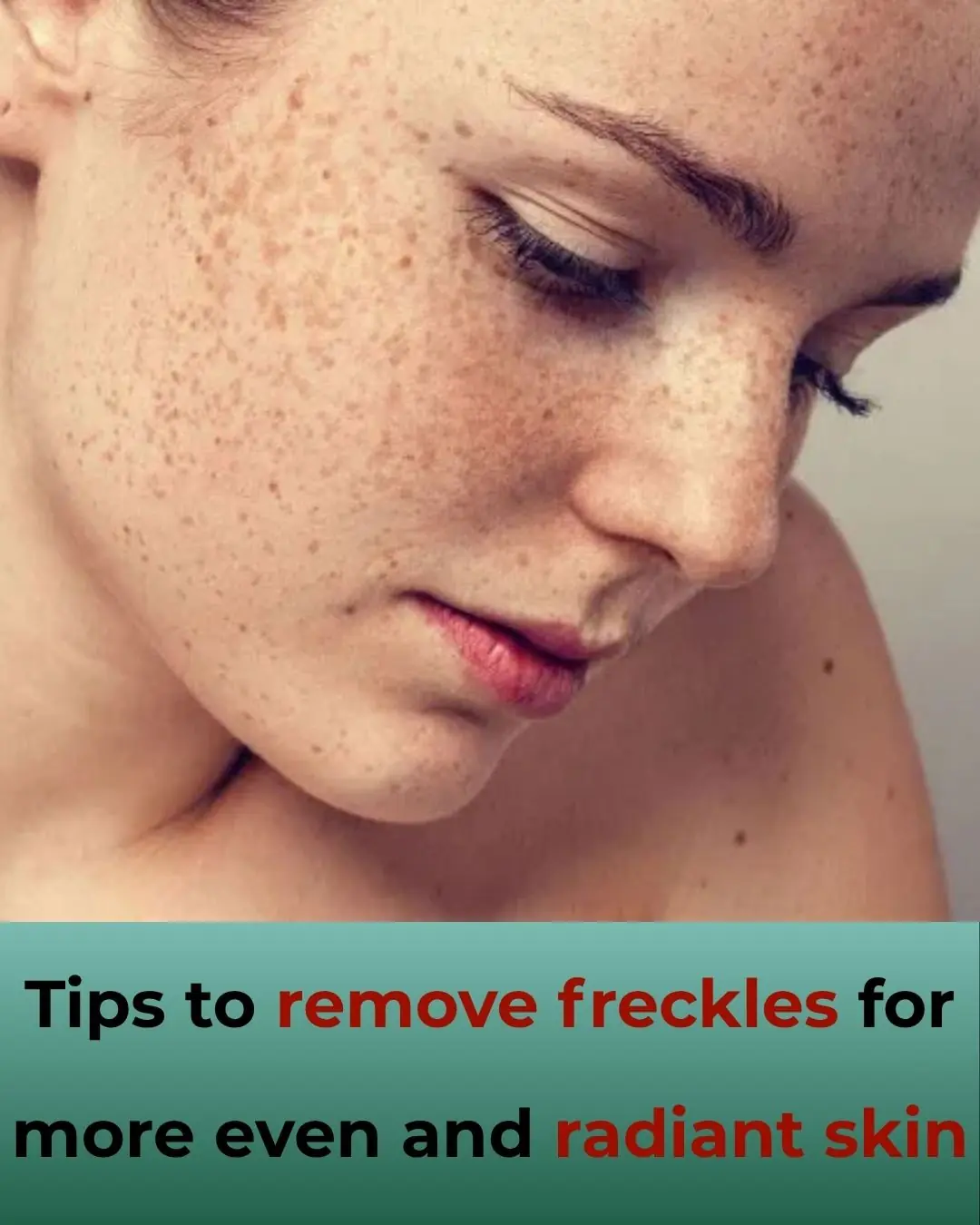 How to Reduce Freckles for a More Even and Radiant Skin Tone
