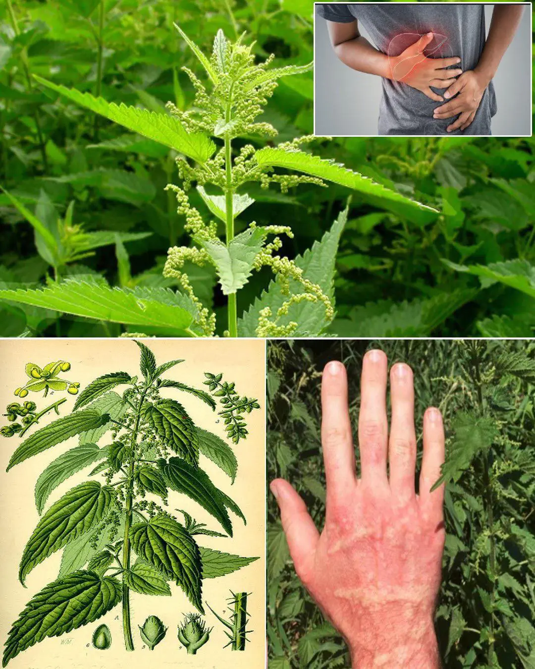 7 Nettle benefits and uses