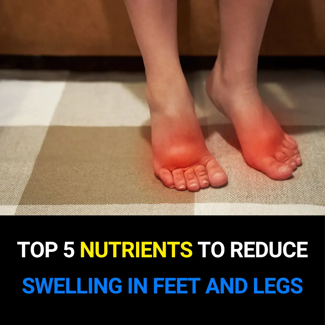 Top 5 Nutrients to Reduce Swelling in Feet and Legs