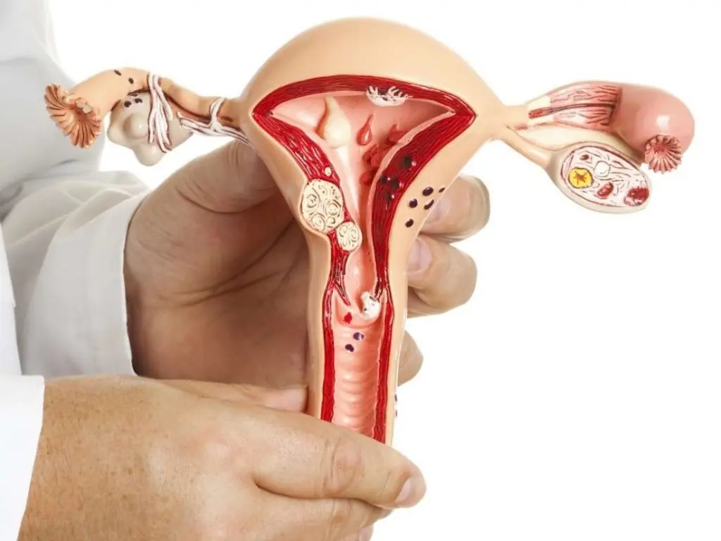 Eating fish in a way many people believe to be highly nourishing, the young woman ended up with premature ovarian failure and a body full of mercury