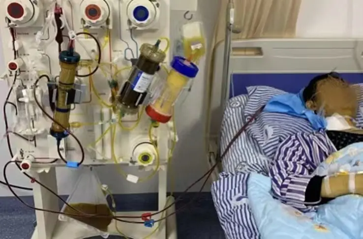 A 30-year-old man suddenly suffered kidney failure: 5 daily habits that silently destroy the kidneys