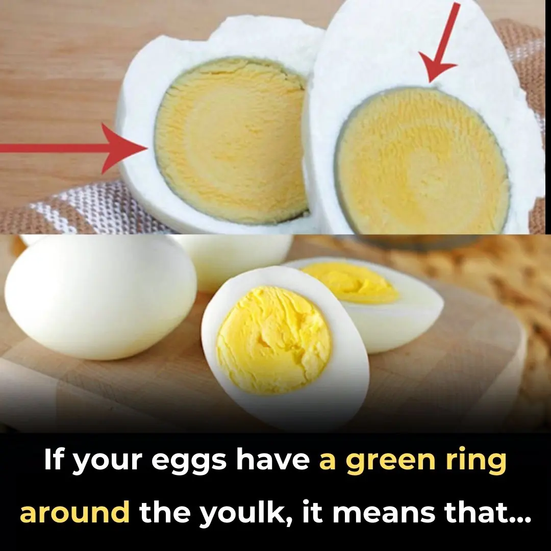 Why Your Hard-Boiled Eggs Have That Weird Green Ring