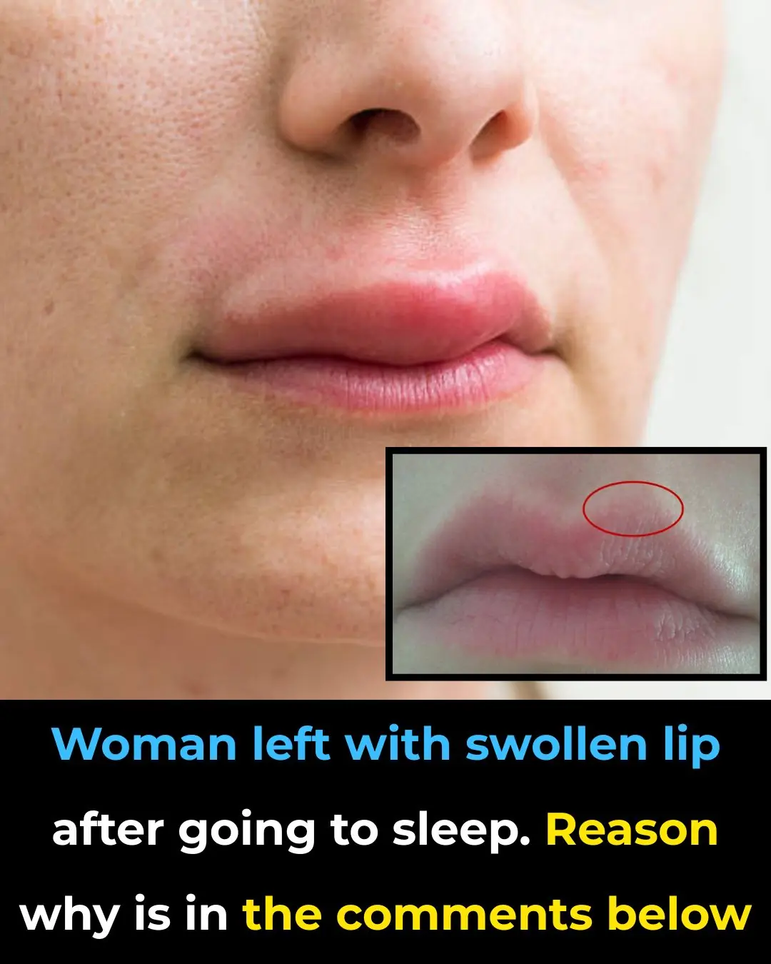 Woman Left with Swollen Lip After Centipede Bites Her in Sleep