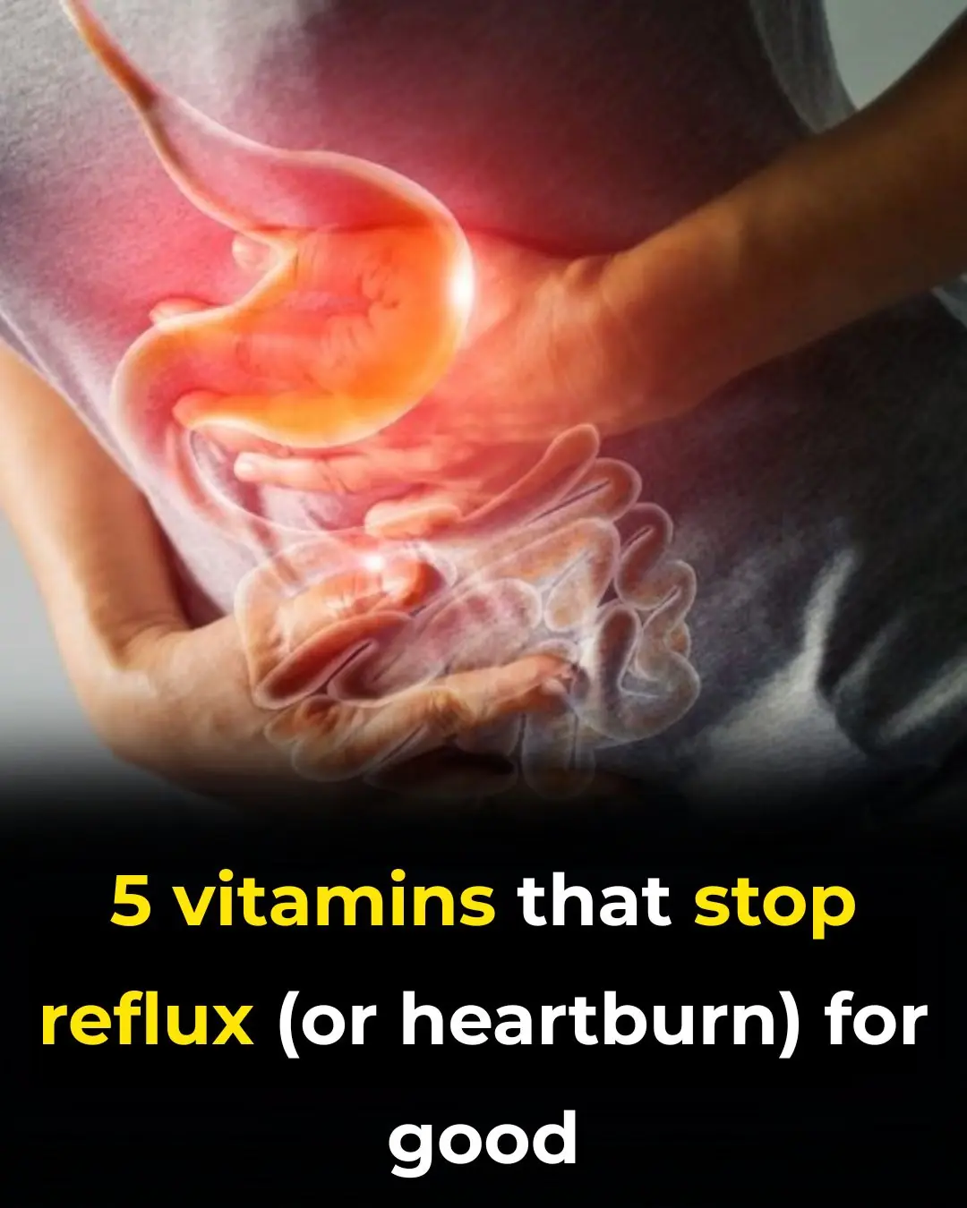 5 Powerful Vitamins That Help Stop Acid Reflux Naturally