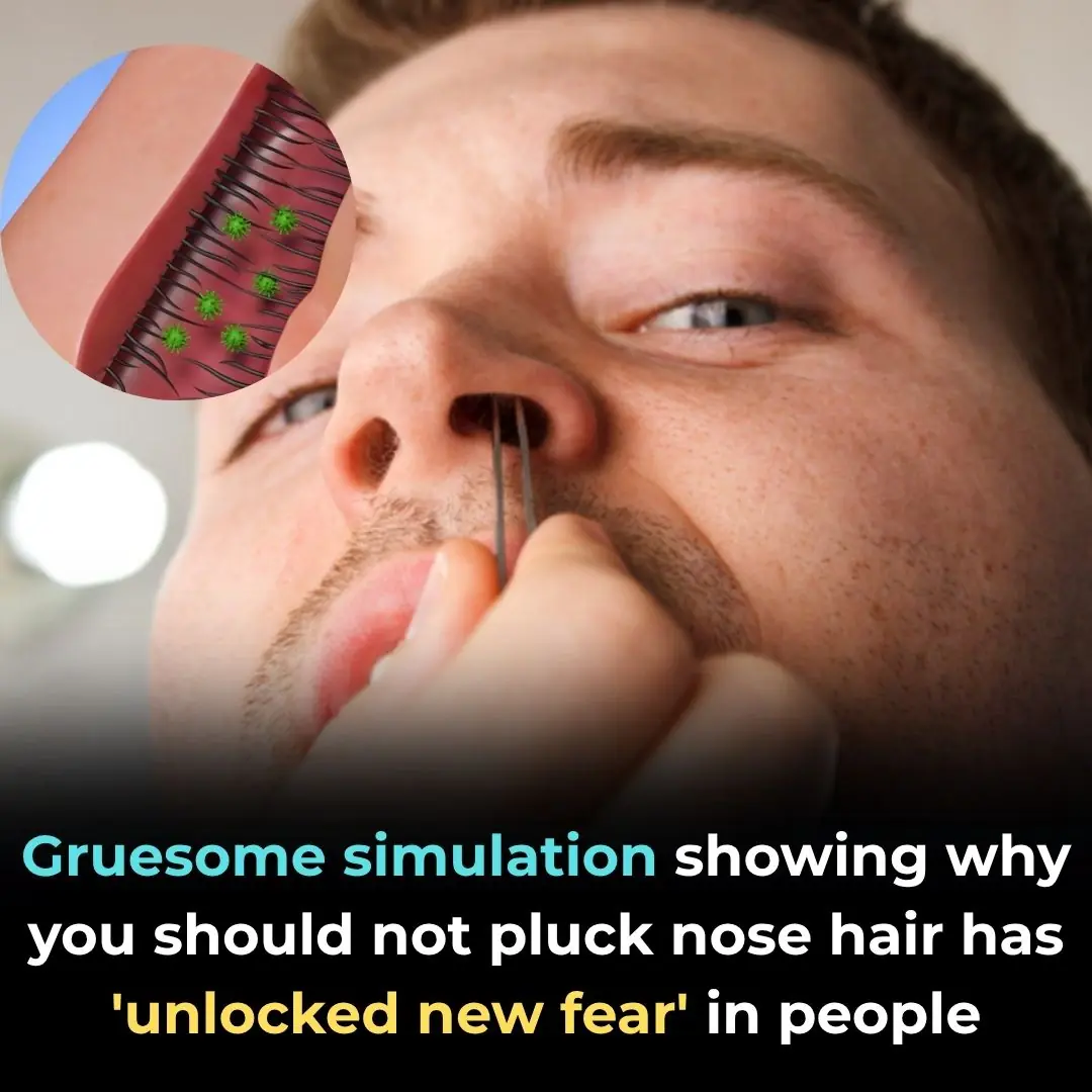 Why You Shouldn’t Pluck Your Nose Hairs