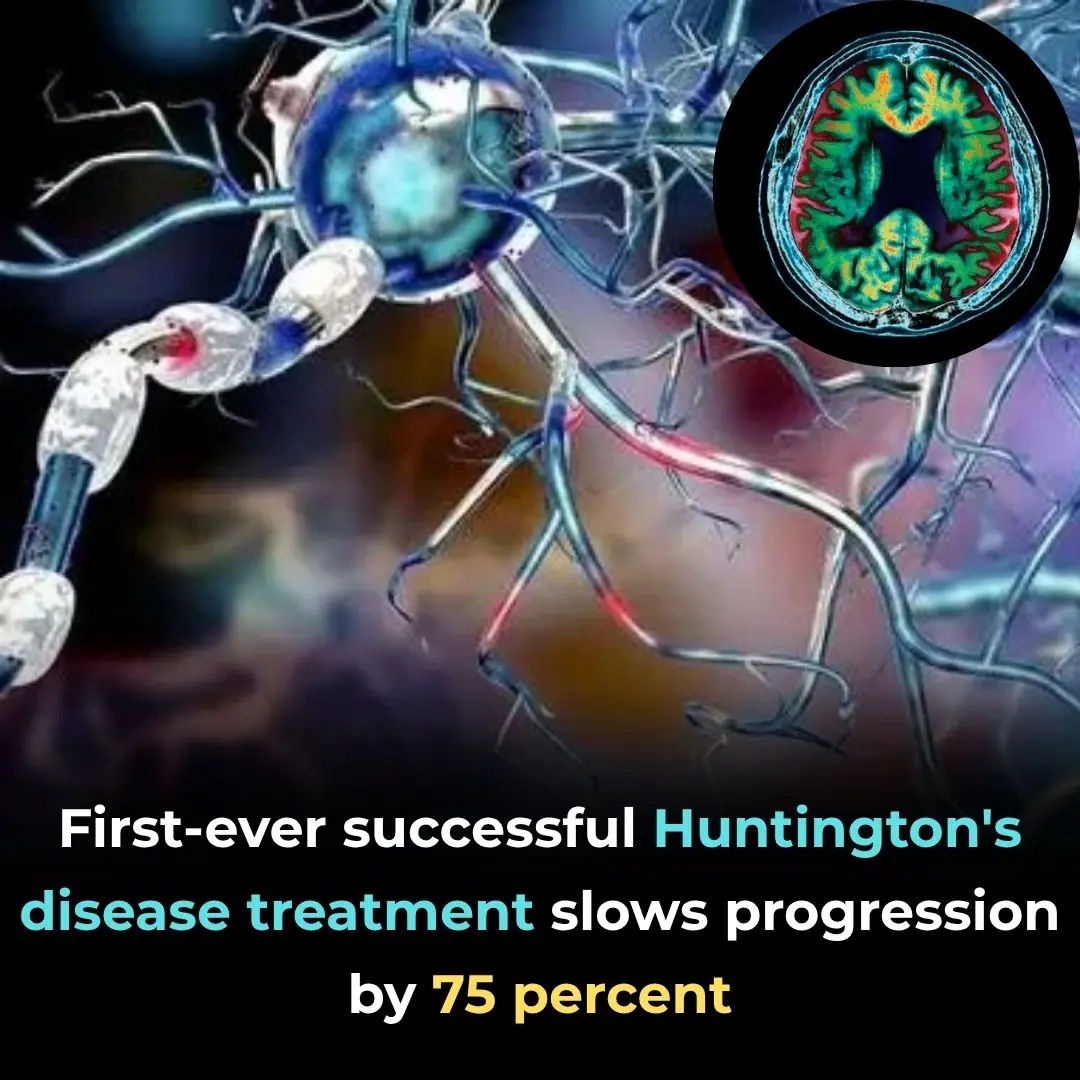 The Dawn of Genetic Healing: A New Hope for Huntington’s Disease