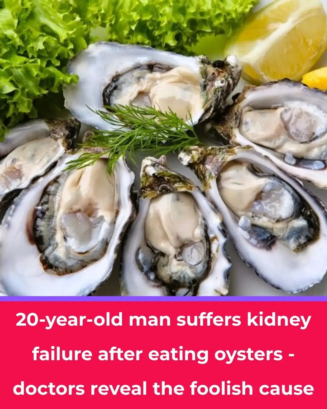 20-year-old Young Man Suddenly Suffers Acute Kidney Failure After Eating Oysters: Doctor Reveals the “Hidden” Cause