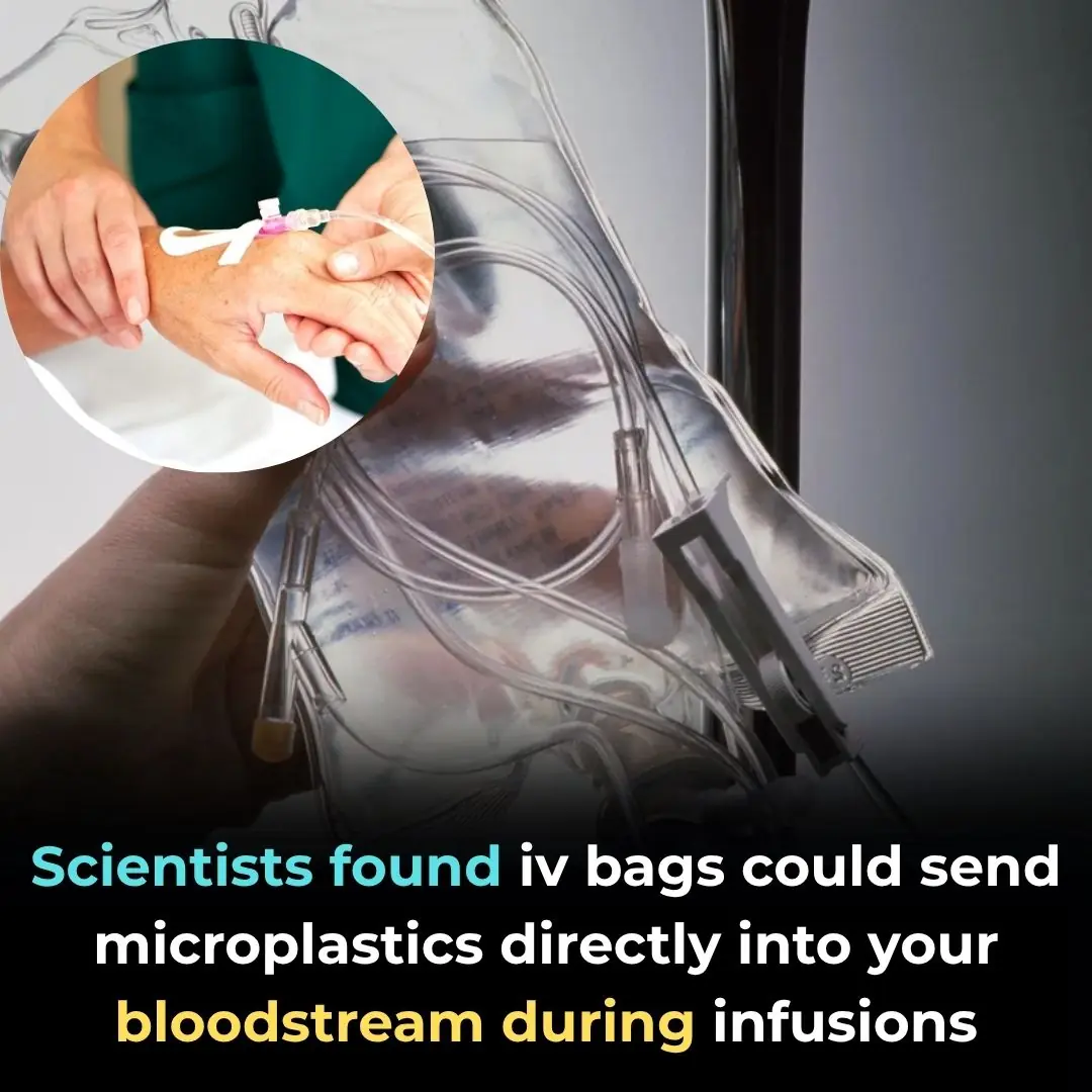 Scientists Found IV Bags Could Send Microplastics Directly Into Your Bloodstream During Infusions