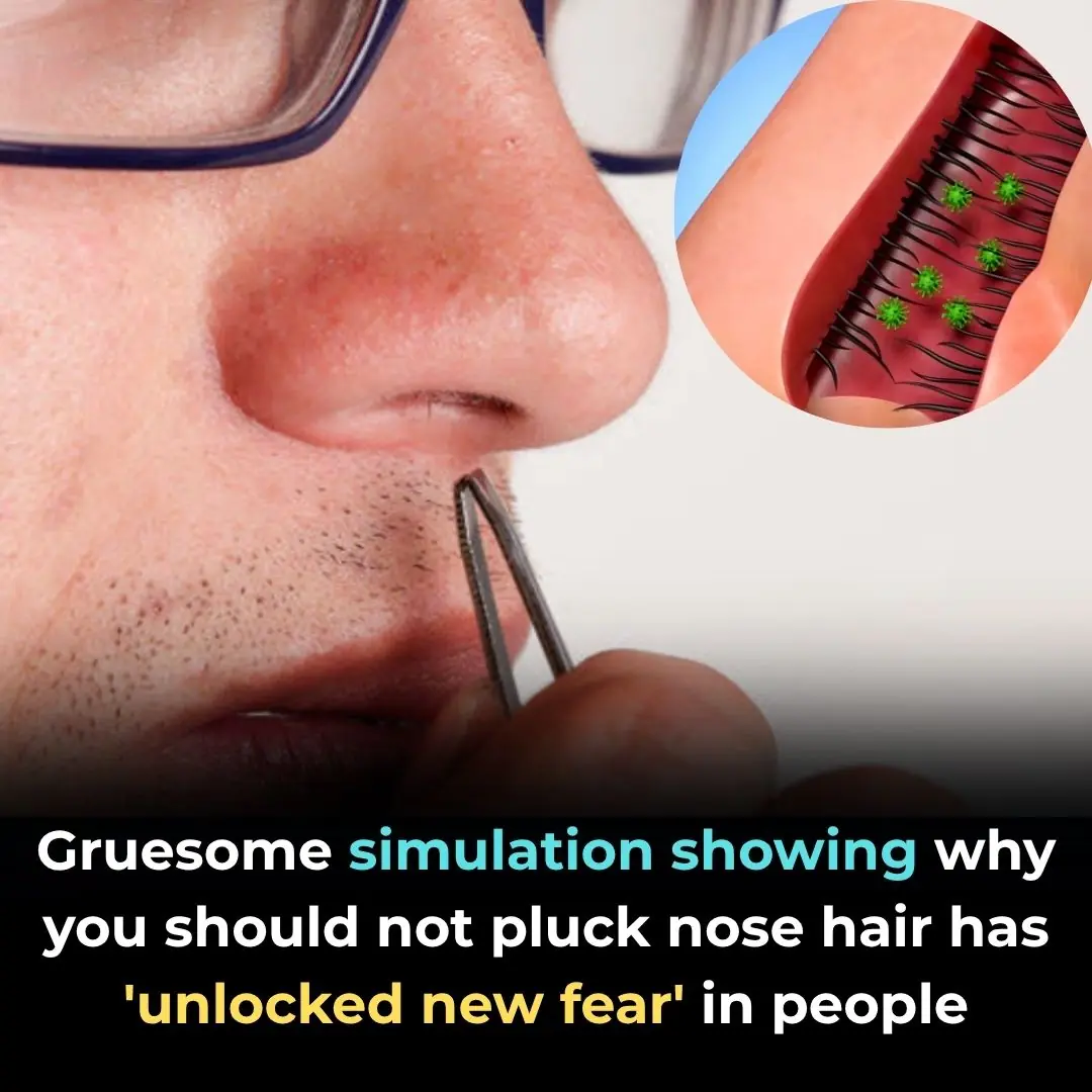 Why You Shouldn’t Pluck Your Nose Hairs