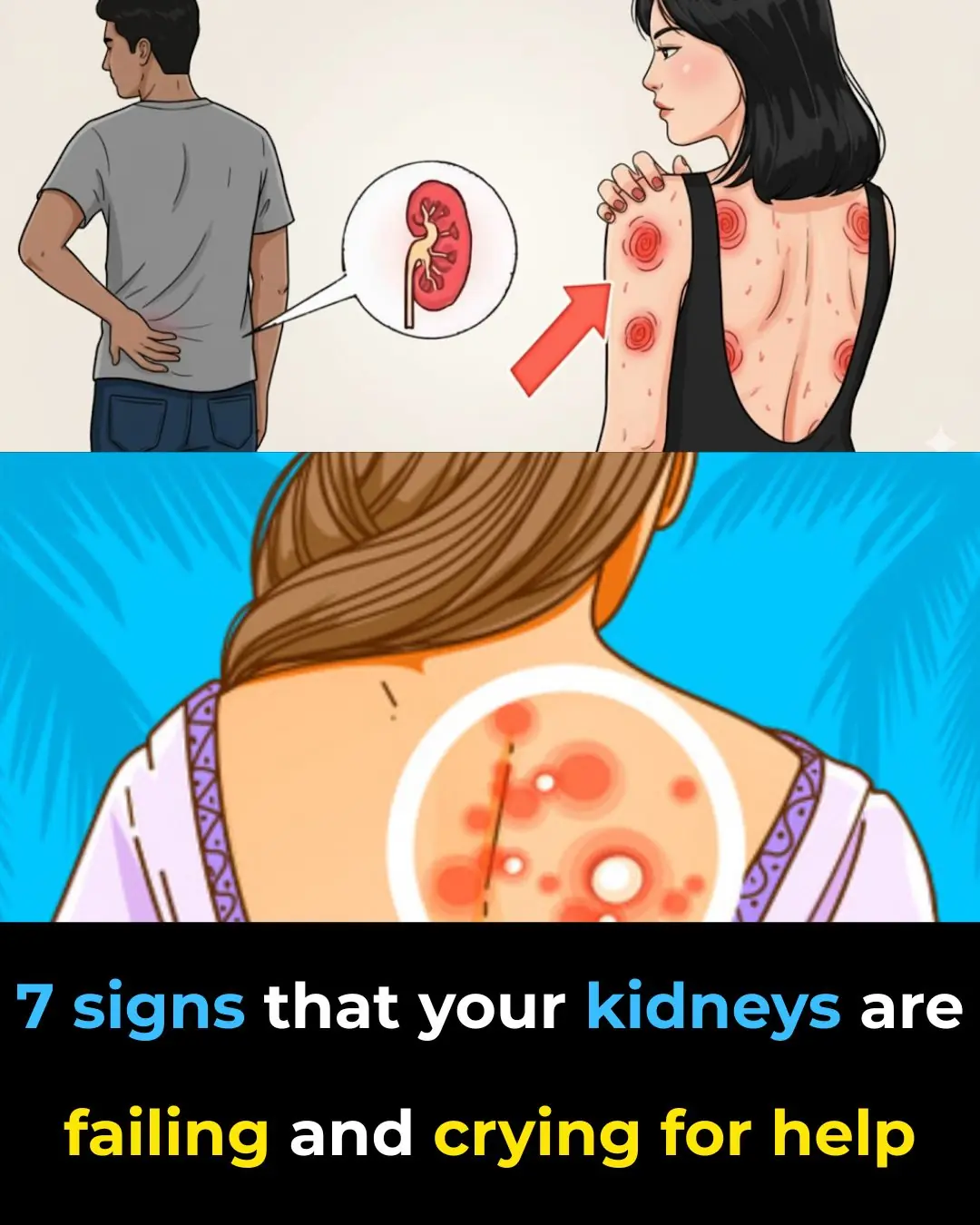 ALERT! 7 Early Signs Your Kidneys Are Crying for Help