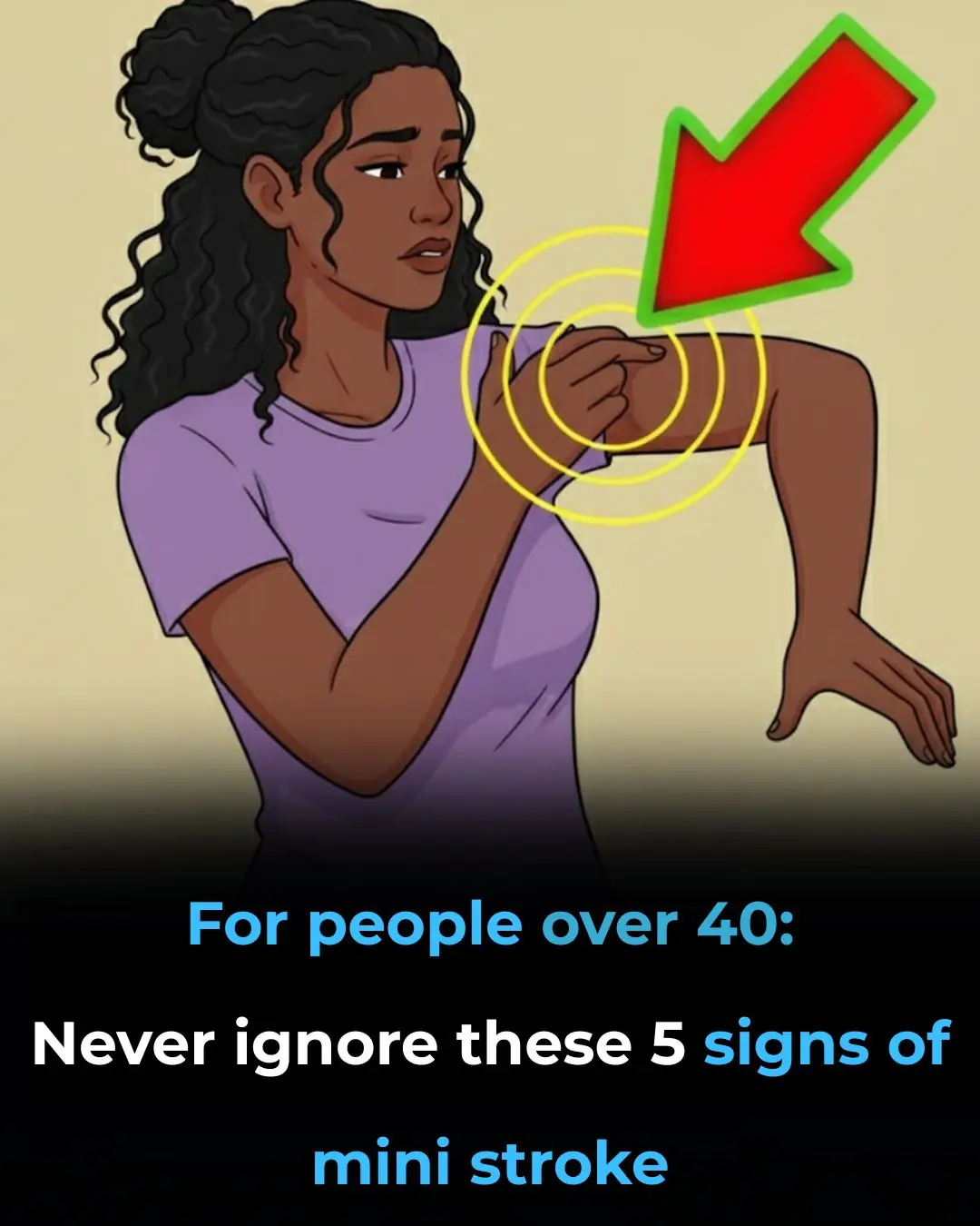 Mini Stroke in People Over 40