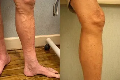 5 Surprising Causes of Weak Legs in Seniors—and How to Fix Them