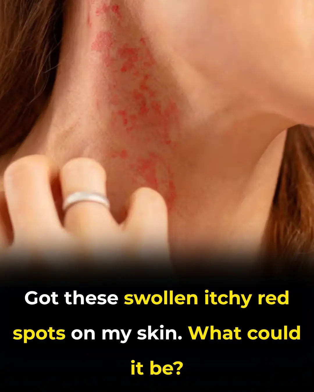 Ugh, these so annoying