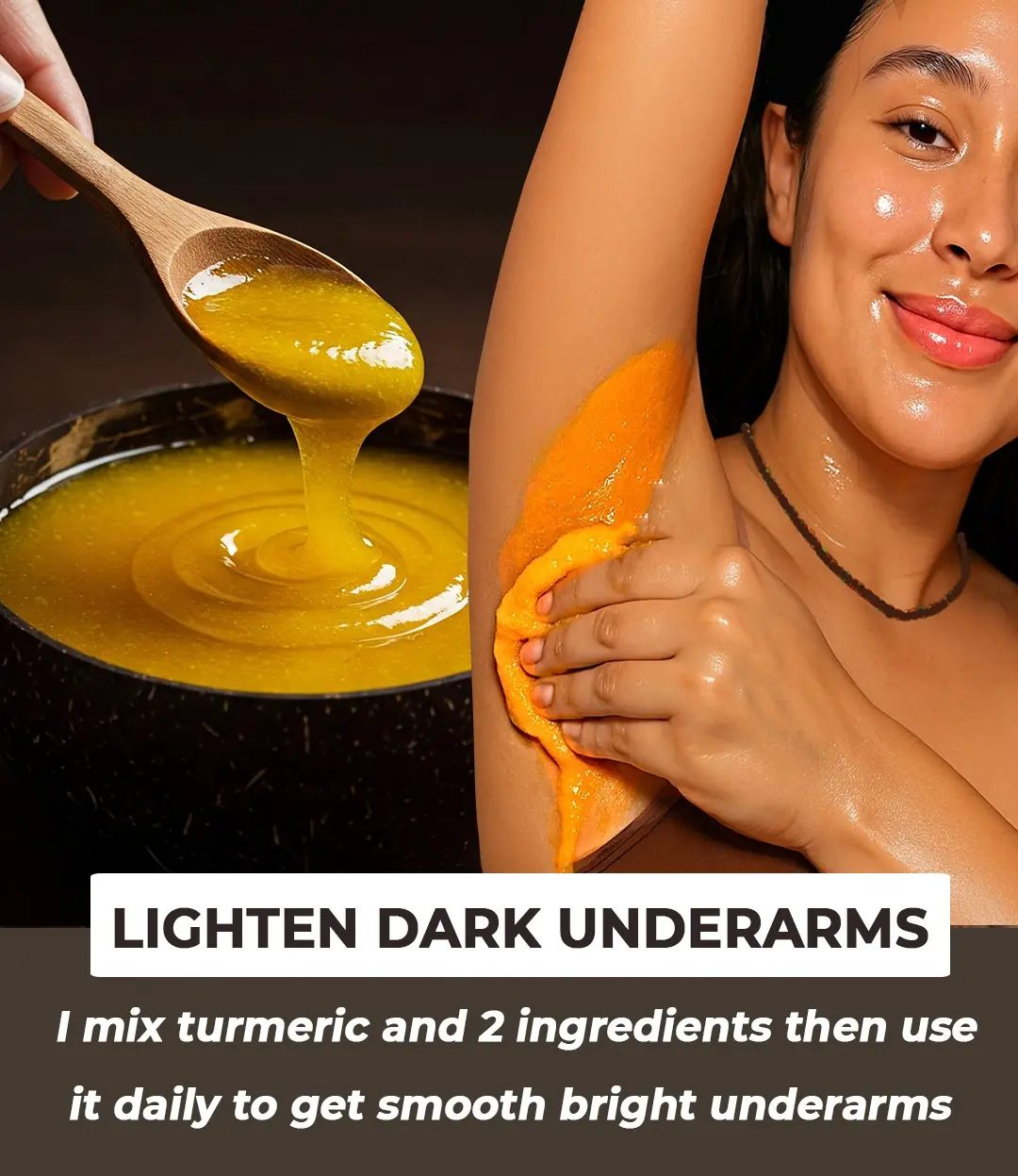 6 Home Remedies to Lighten Dark Underarms | How to get rid of Dark Underarms