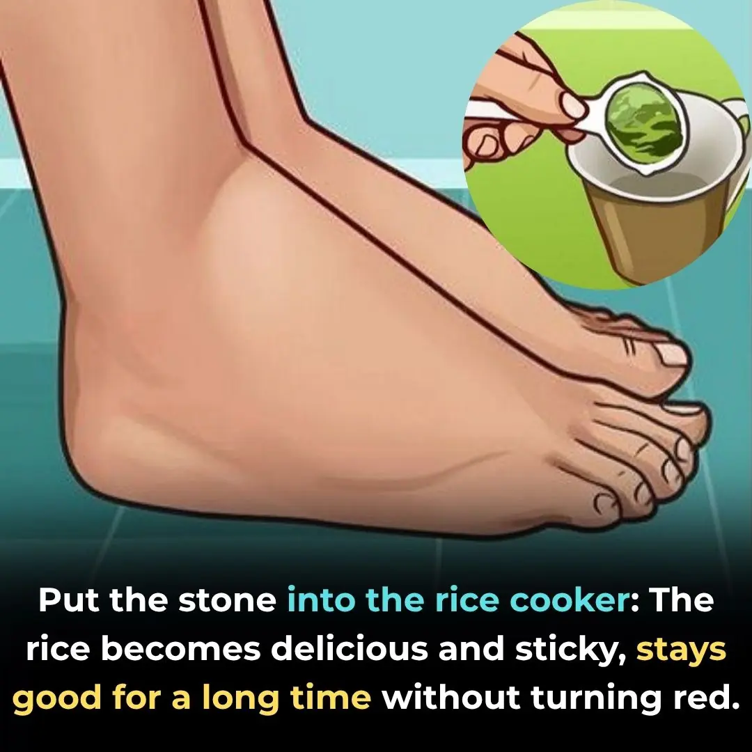 Eliminate Excess Water and Prevent Hand and Foot Swelling with These Effective Recipes