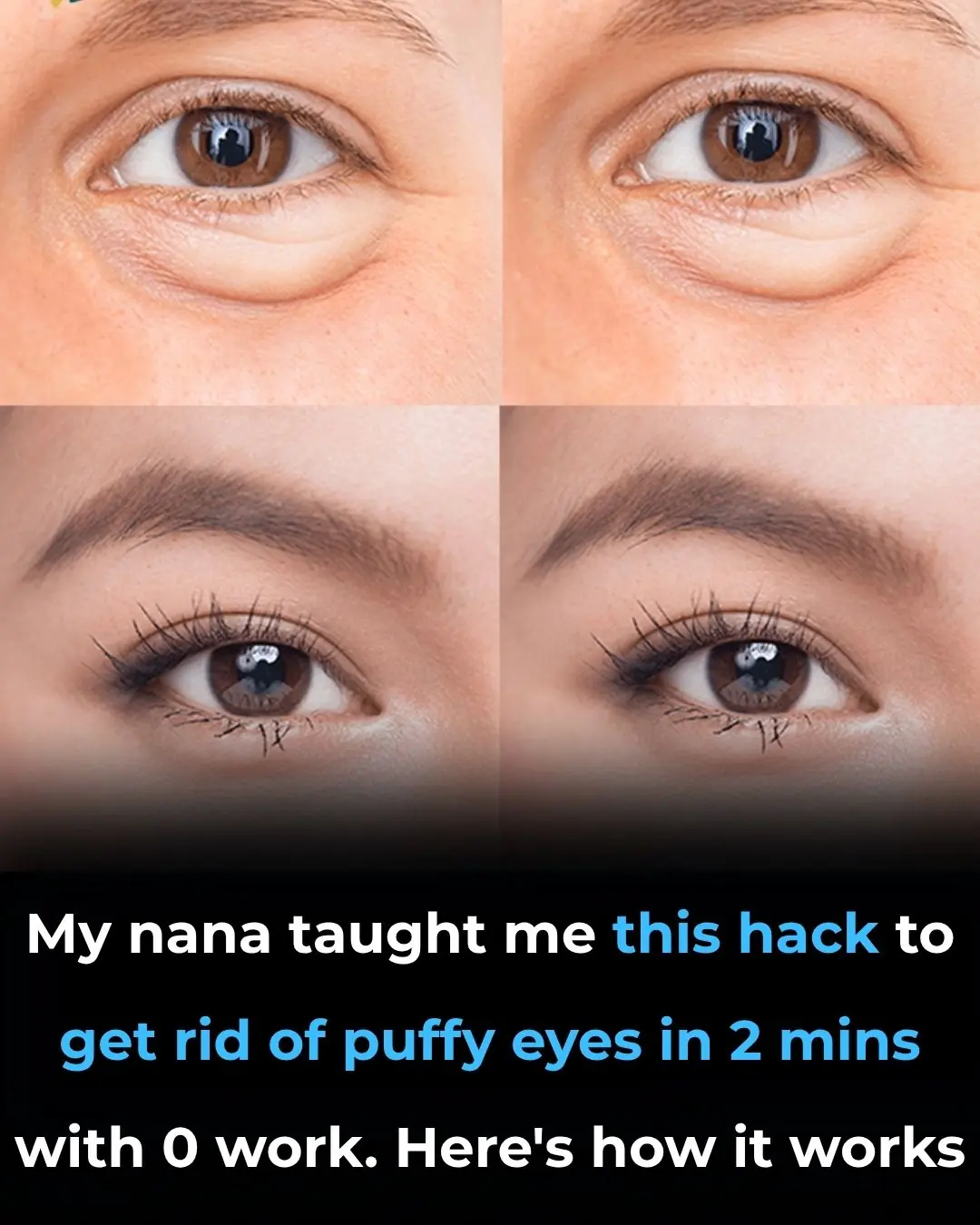 My nana taught me this hack to get rid of puffy eyes in 2 mins with 0 work. Here’s how it works
