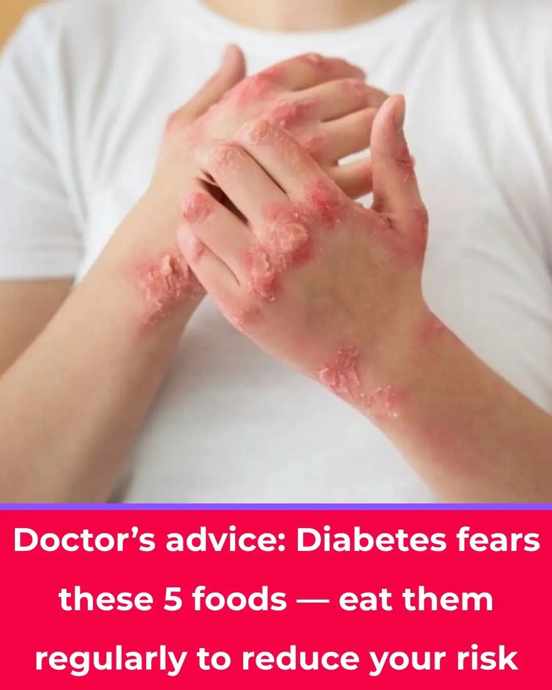 Everyone Fears Diabetes — But Diabetes “Fears” These 5 Foods the Most