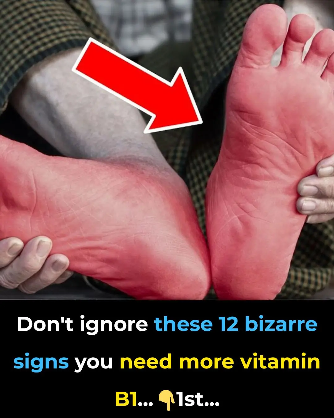 Don’t ignore these 12 bizarre signs you need more vitamin B1!