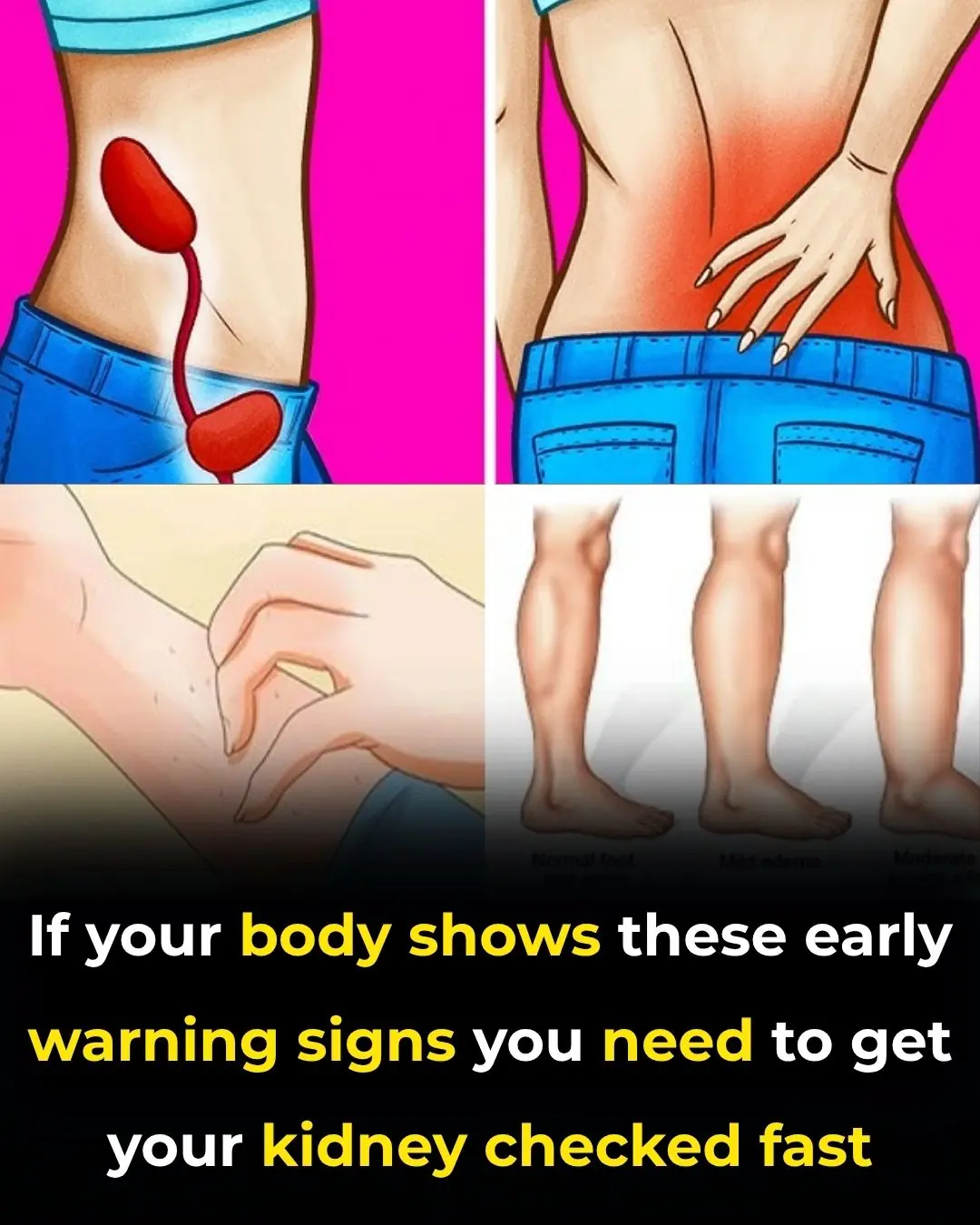 Early Signs of Kidney Disease & How to Protect Your Kidneys (Evidence Based)