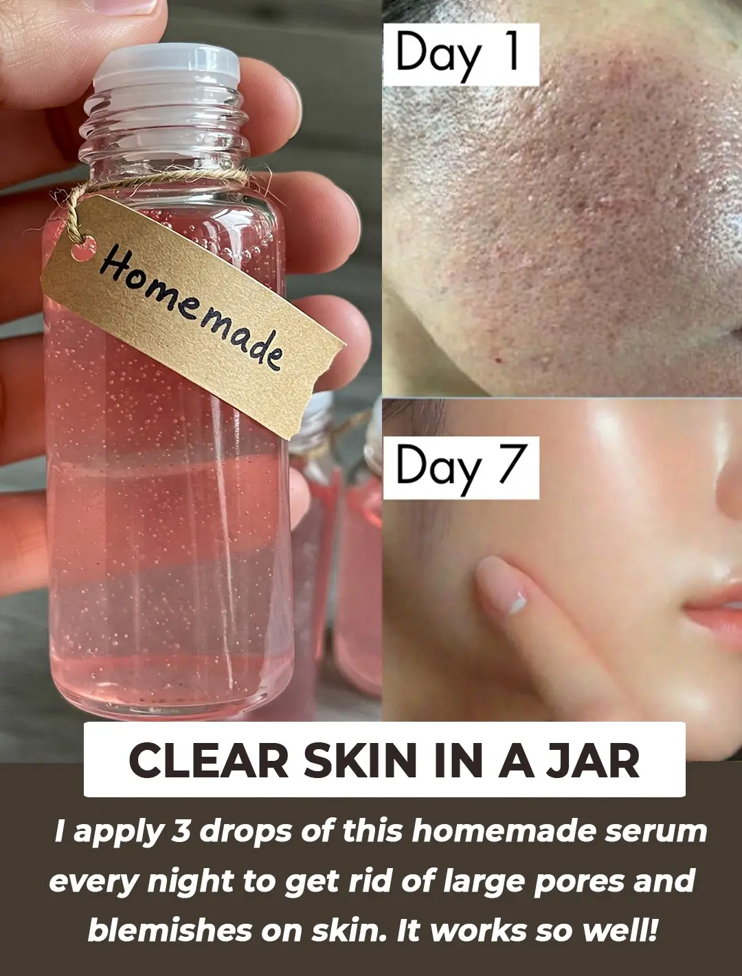 Use This Toner Daily To Get Rid of Large Pores Fast