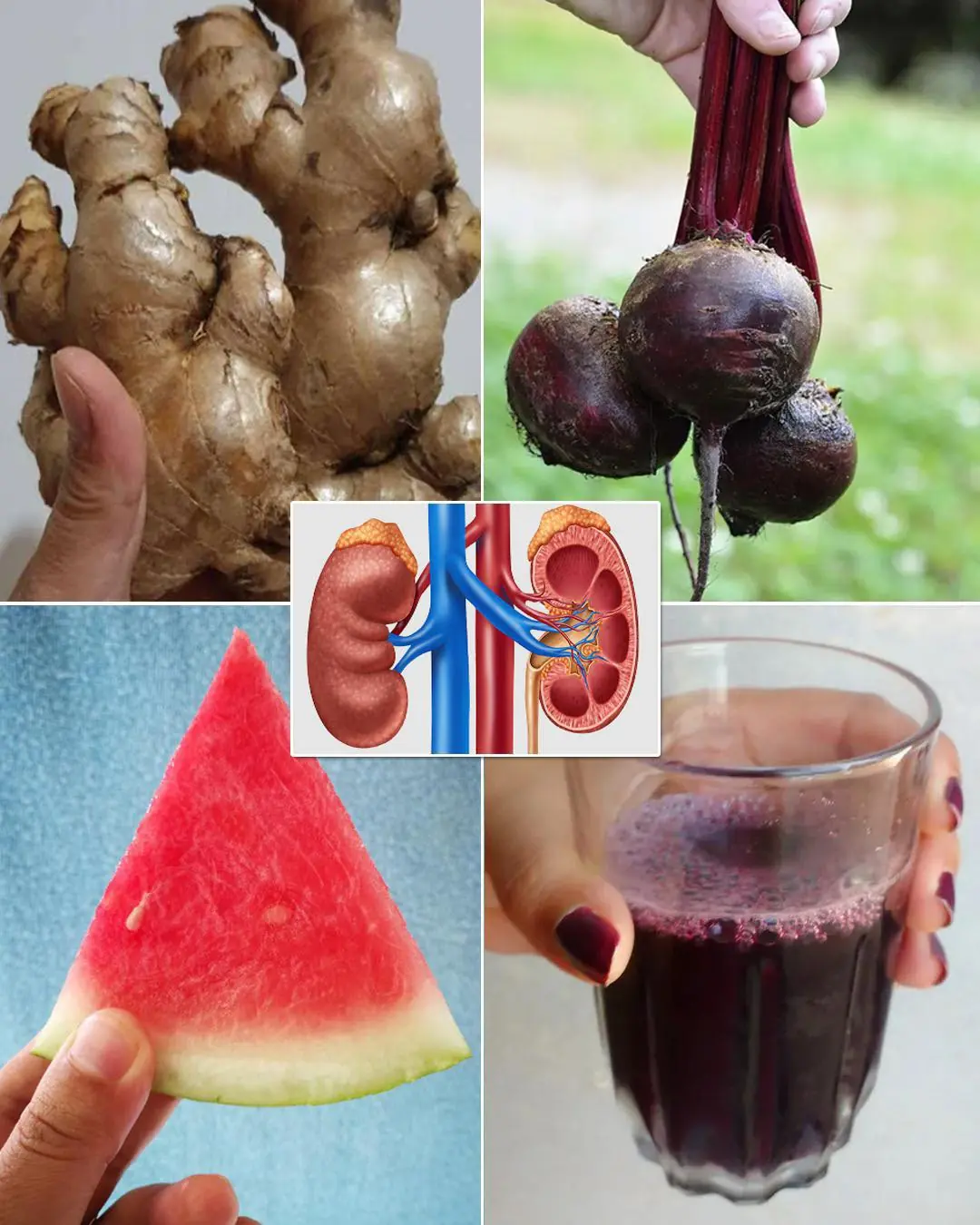 Ginger, Watermelon, and Beetroot Juice: 15-Day Natural Kidney Cleanse