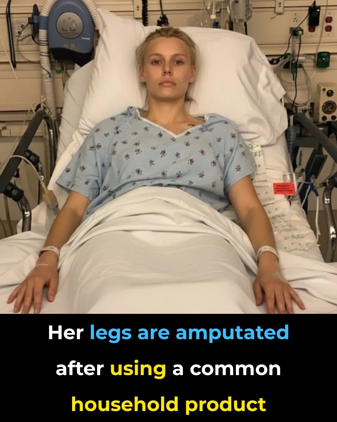 Model Loses Both Legs After Toxic Shock Syndrome From Everyday Tampon Use