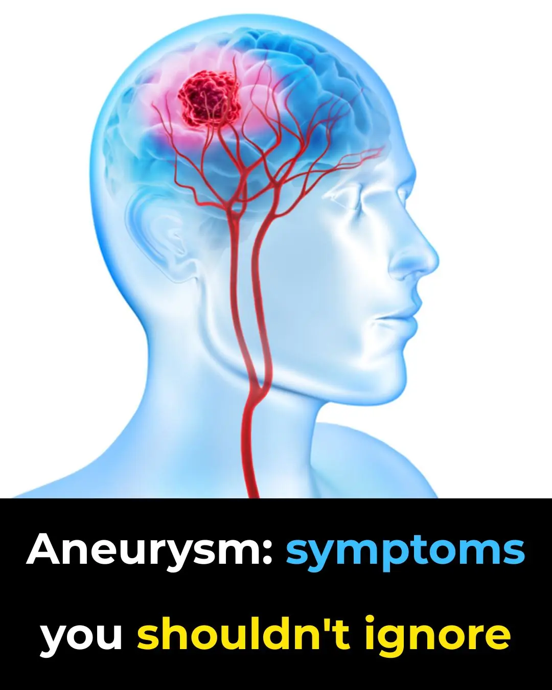 Warning Signs You Should Never Ignore: The Silent Symptoms of a Brain Aneurysm