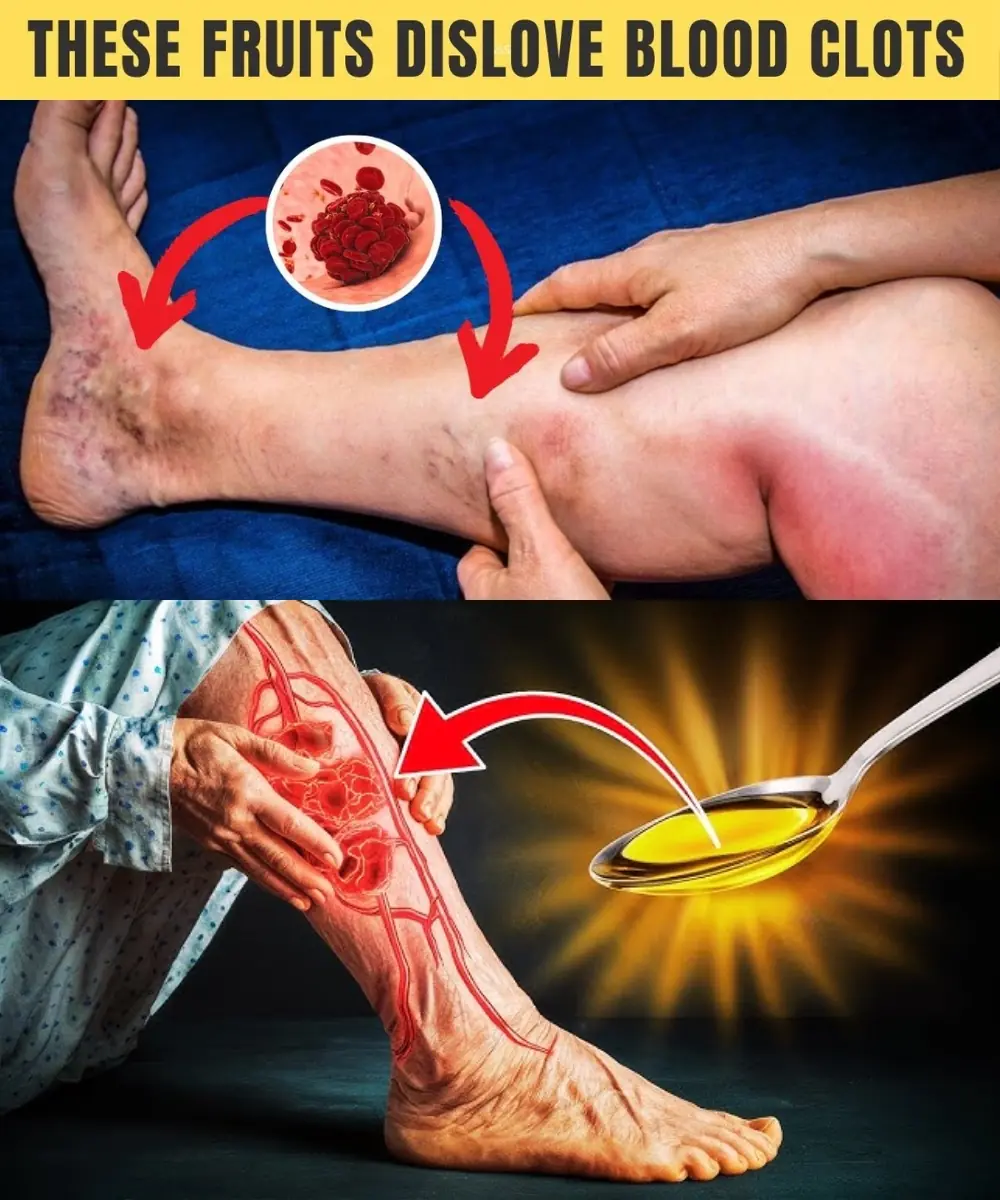 Top 8 Fruits That Naturally Help Dissolve Blood Clots