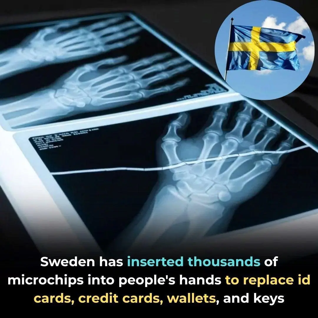 Inside Sweden’s Cashless Future: Thousands Opt for Microchip Implants
