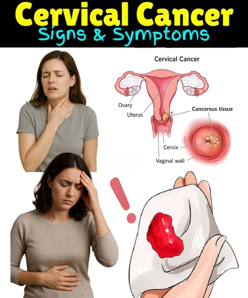 Cervical Cancer: Early Signs and Symptoms You Should Never Ignore