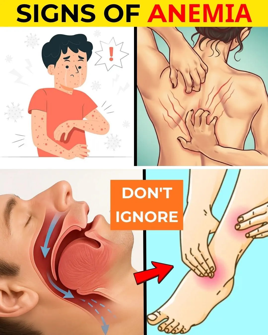 Silent Symptoms of Anemia You Should Never Ignore