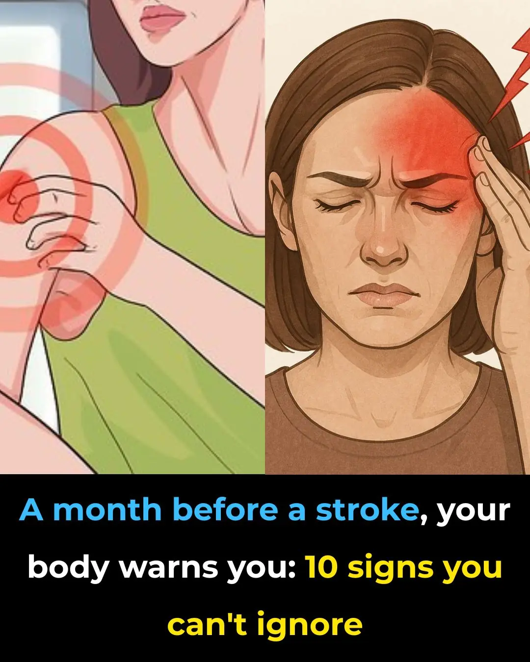 🧠 A Stroke Can Happen Suddenly — But Your Body Might Send Early Warnings (Know the Signs)
