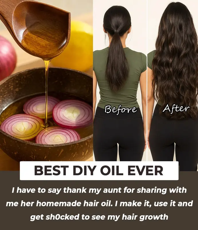Transform Your Hair Naturally with Onion and Coffee: A Powerful DIY Treatment for Thicker, Healthier Hair