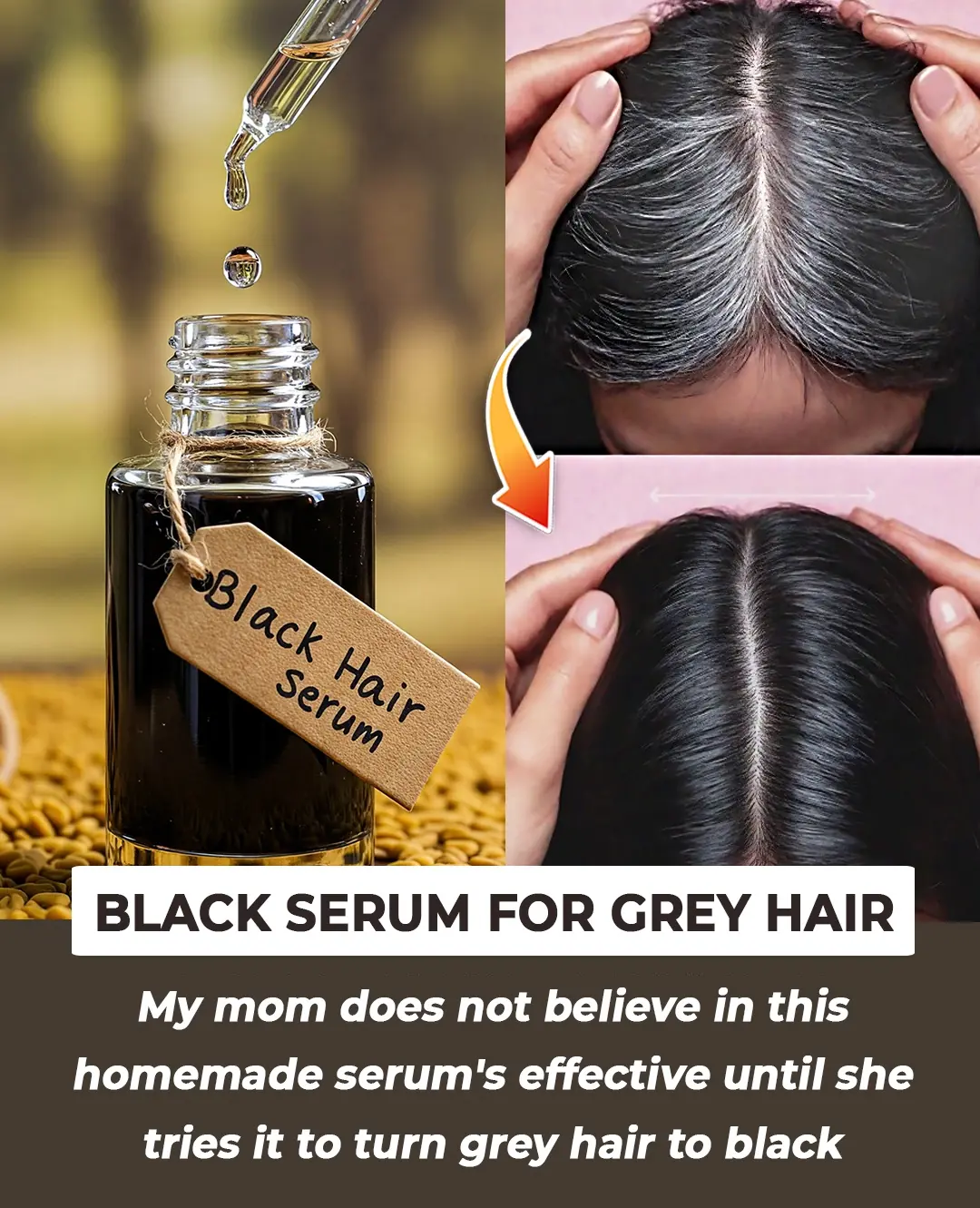 Can You Really Reverse Grey Hair? The Truth Behind Natural Remedies and Modern Treatments