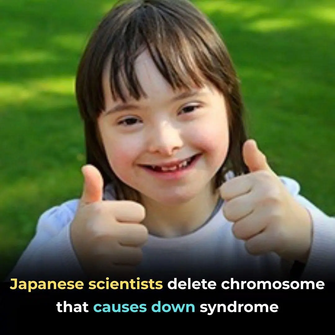 Japanese scientists delete chromosome that causes down syndrome